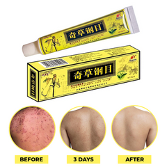 QICAOGANGMU Chinese Herbal Cream Steroid‑Free Relief 15g - 3 Tubes