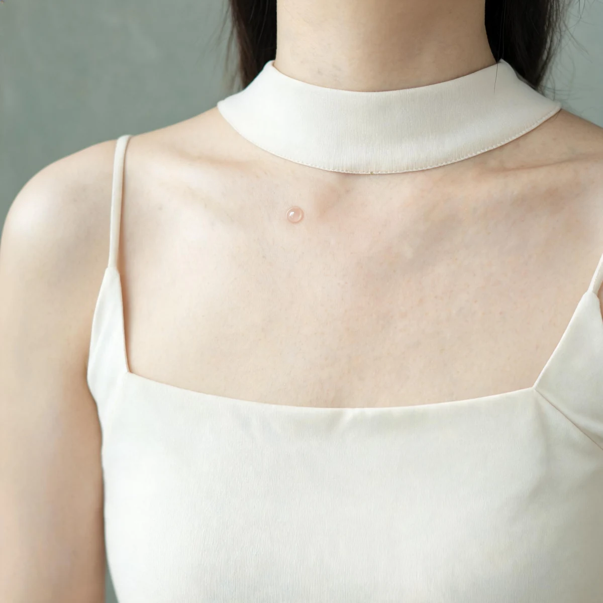 Clinical photograph of the upper chest and breast area of an adult wearing a high-neck cream camisole, with a small blister on the upper breast. No face, nipple or intimate detail is shown.