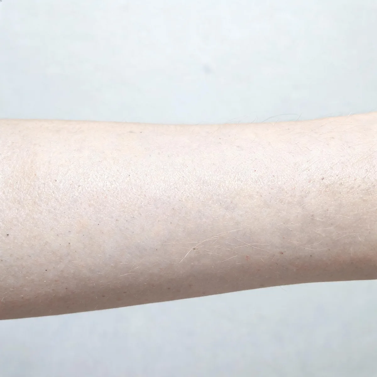 Skin of the forearm with a faint cool sheen and slightly pale colour, normal texture, no lesion or rash.