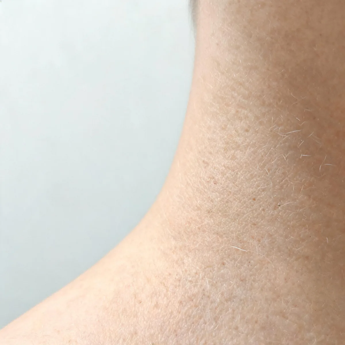 Normal skin at the side of the neck showing natural skin texture with no rash or lesion, no body odour source visible.