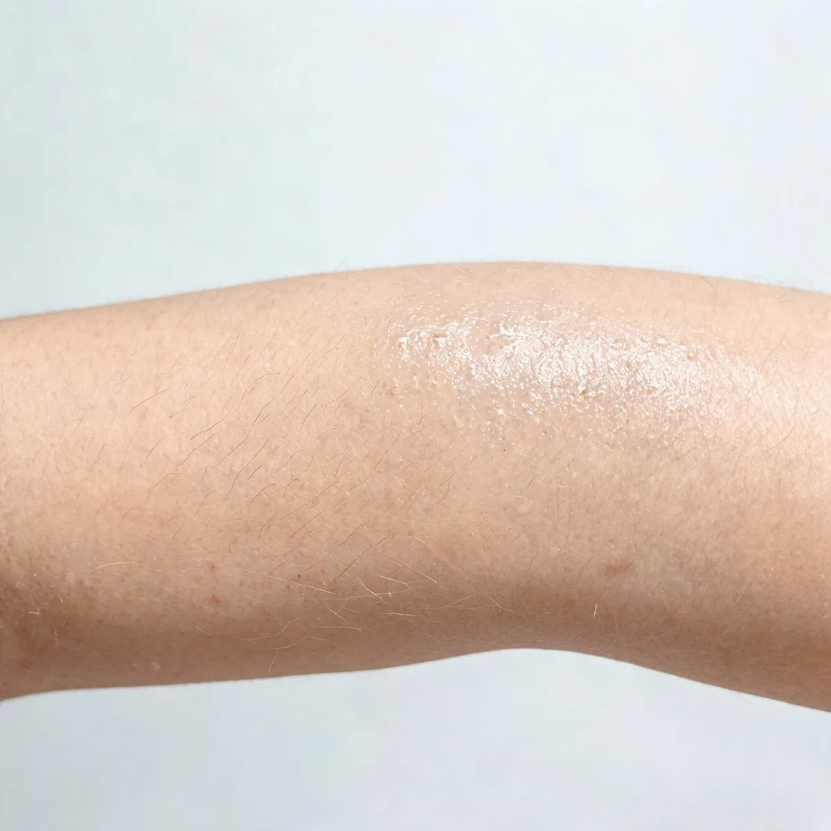 Skin of the forearm with a faint damp sheen and normal skin texture, no rash or lesion.